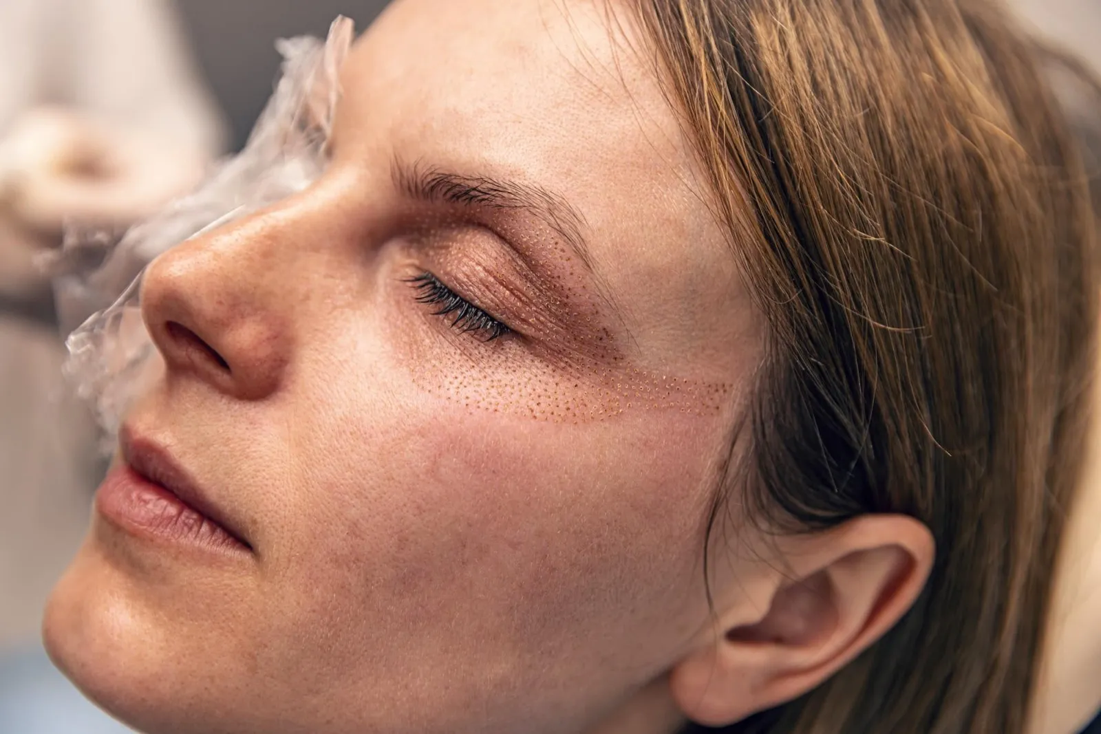 Frau mit geschlossenen Augen und einem Pad unter dem Auge nach einer Plasma-Behandlung zur Hautstraffung